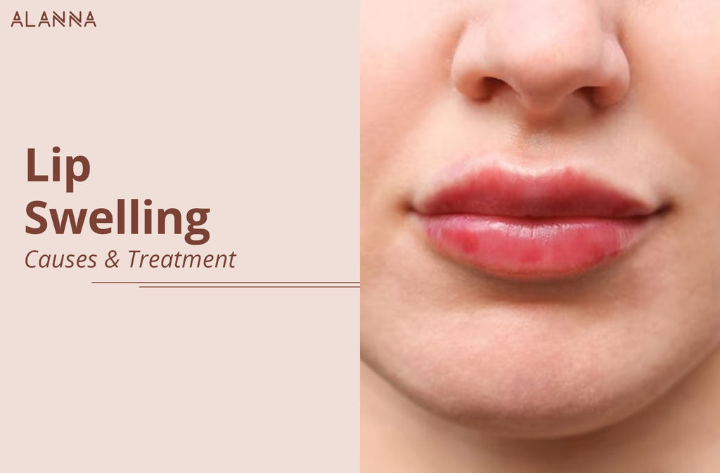 Lip Swelling : Causes & Treatments – ALANNA