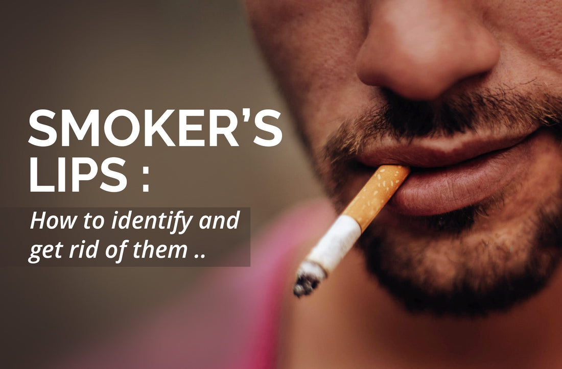 Smoker's Lips 