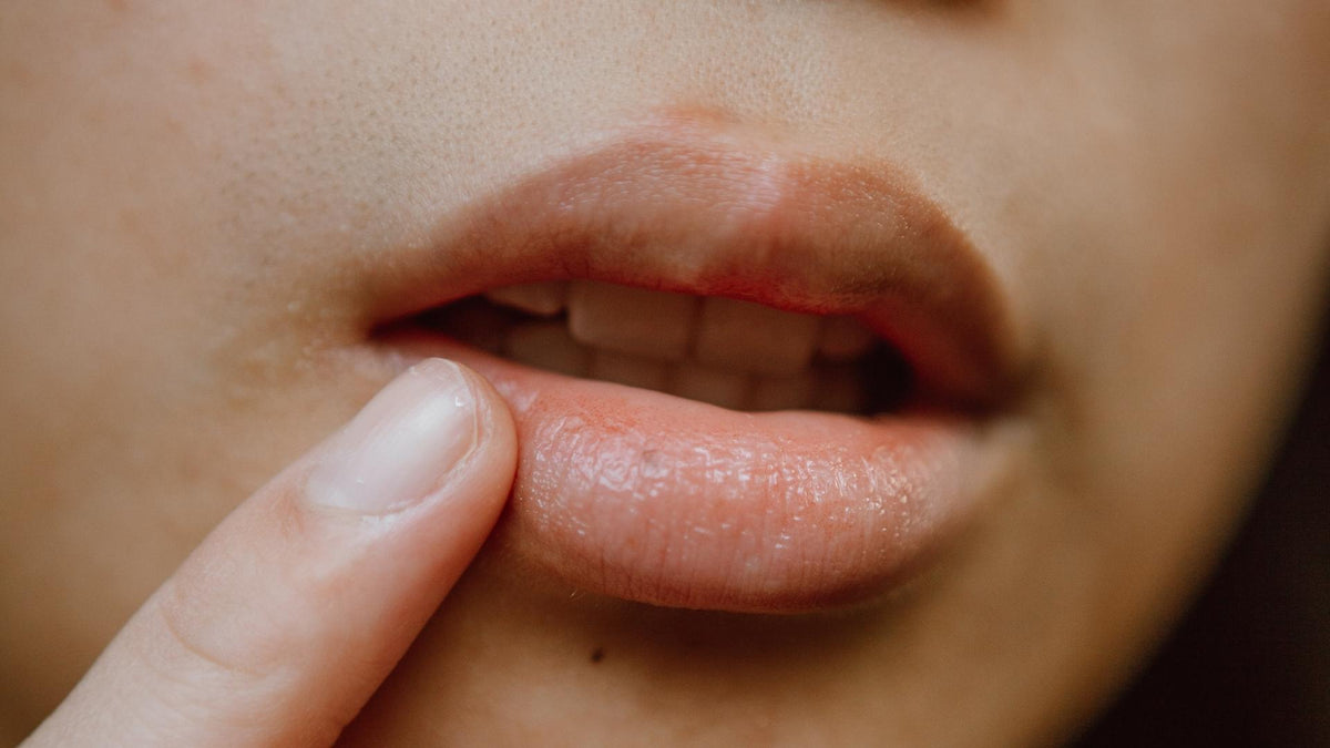 Pigmented Lips