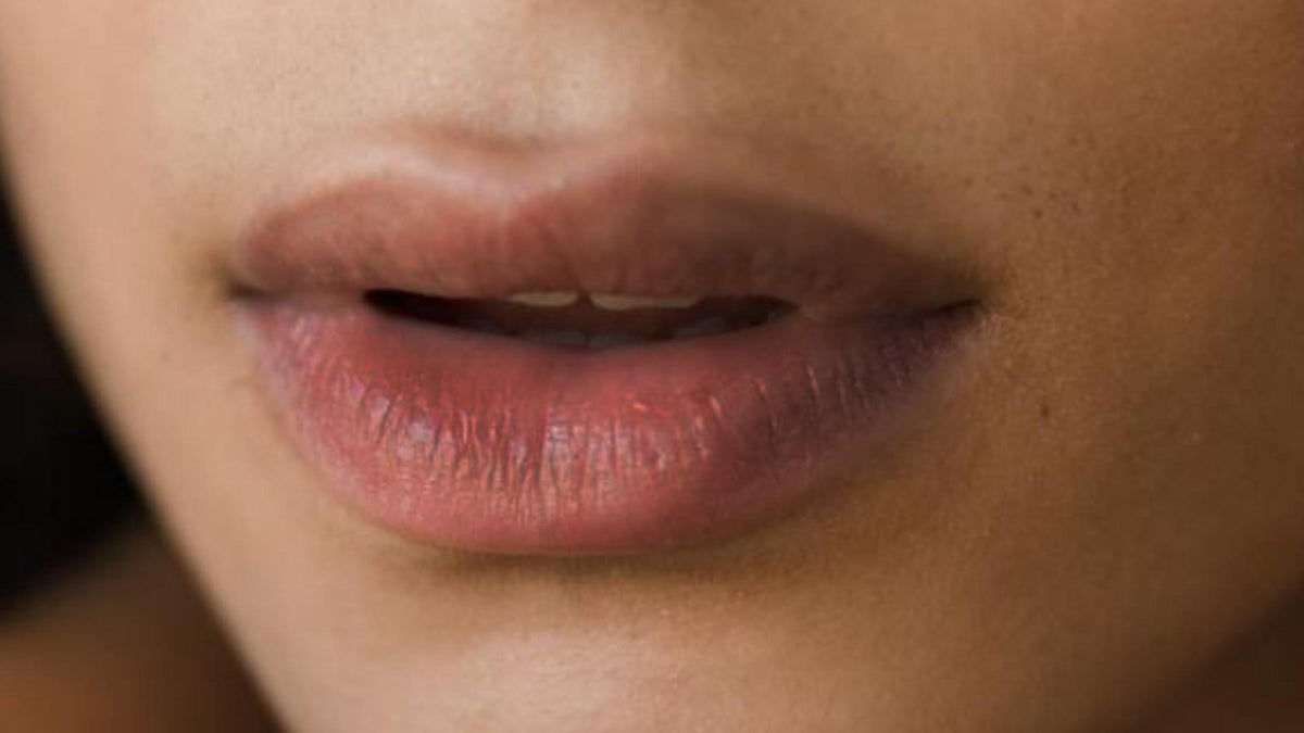 Pigmented Lips