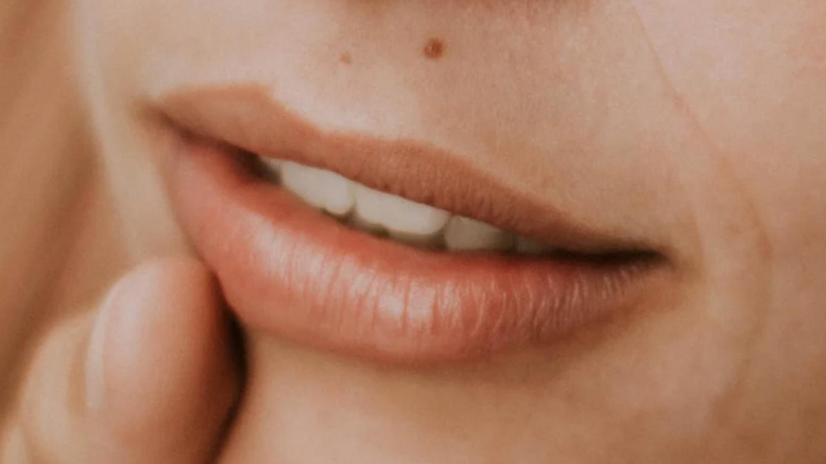 Hyperpigmented Lips