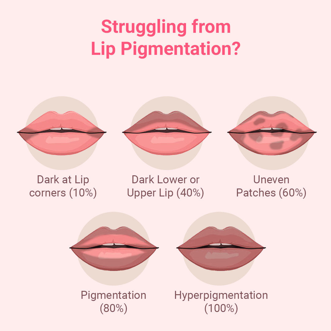 Levels of Lip Pigmentation