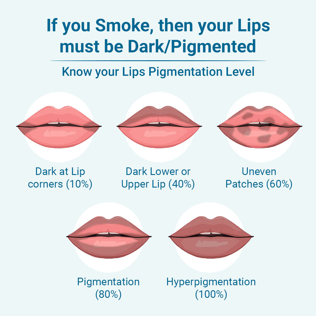 Lip Pigmentation Level