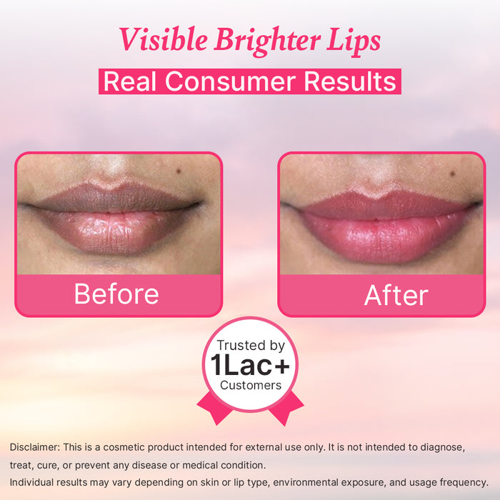 LipWash® | Women | Kiss Ready Lips