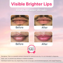 LipWash® | Couple (Alpha Arbutin And Feluric Acid)