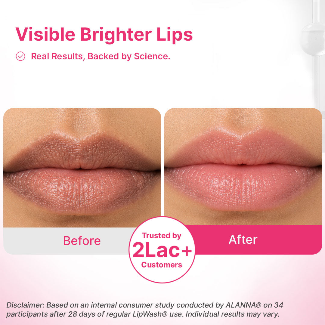Lip Pigmentation Treatment Kit | 4-Step | Women
