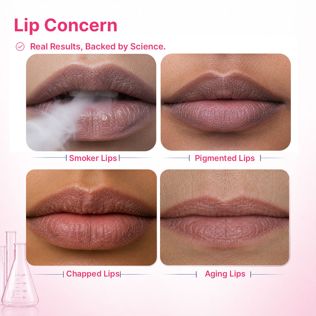 Lip Pigmentation Treatment Kit | 4-Step | Women