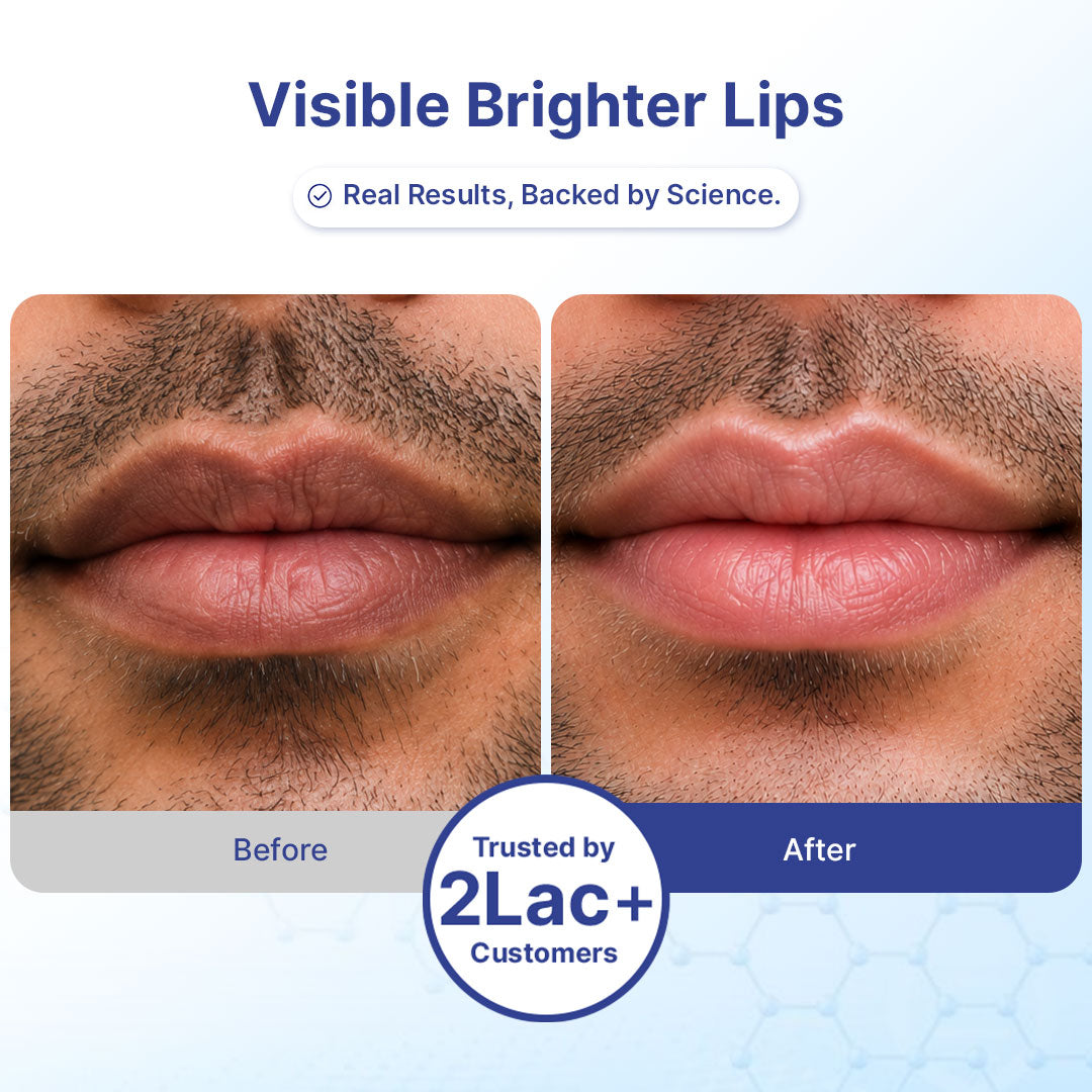 Smoker's Lip Treatment Kit | 4-Step | Men