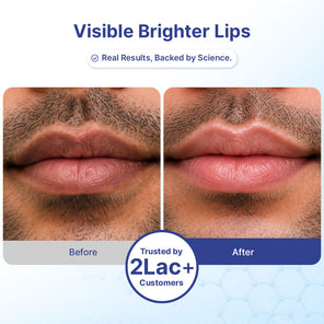 Smoker's Lip Treatment Kit | 4-Step | Men