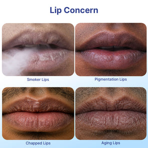 Smoker's Lip Treatment Kit | 4-Step | Men