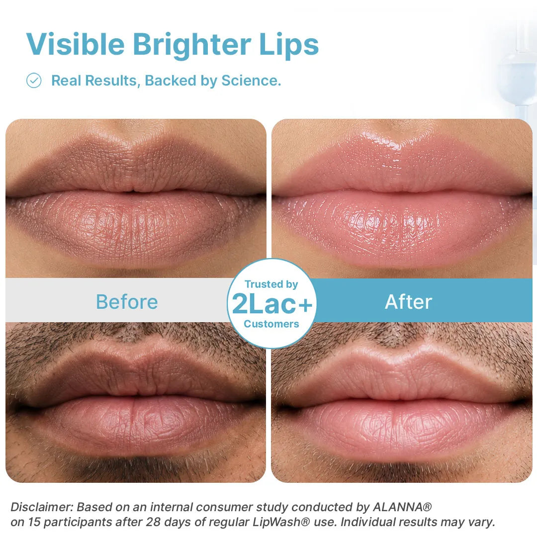 Lip Pigmentation Treatment Kit · 5-Step · Unisex