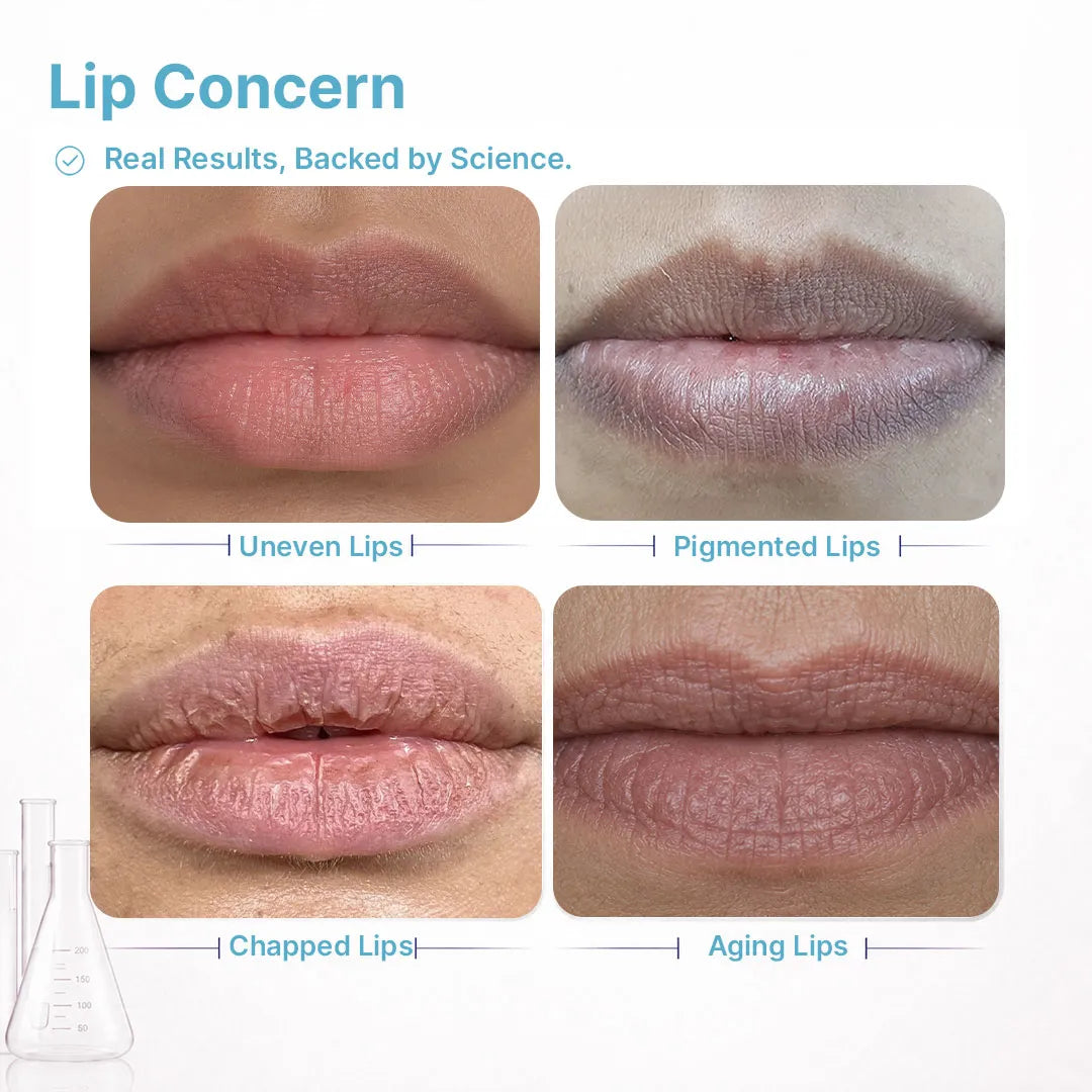 Lip Pigmentation Treatment Kit · 5-Step · Unisex