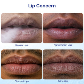 Lightening Lip Pro Kit | Men | 2-Step | LipWash® + SPF Lip Balm
