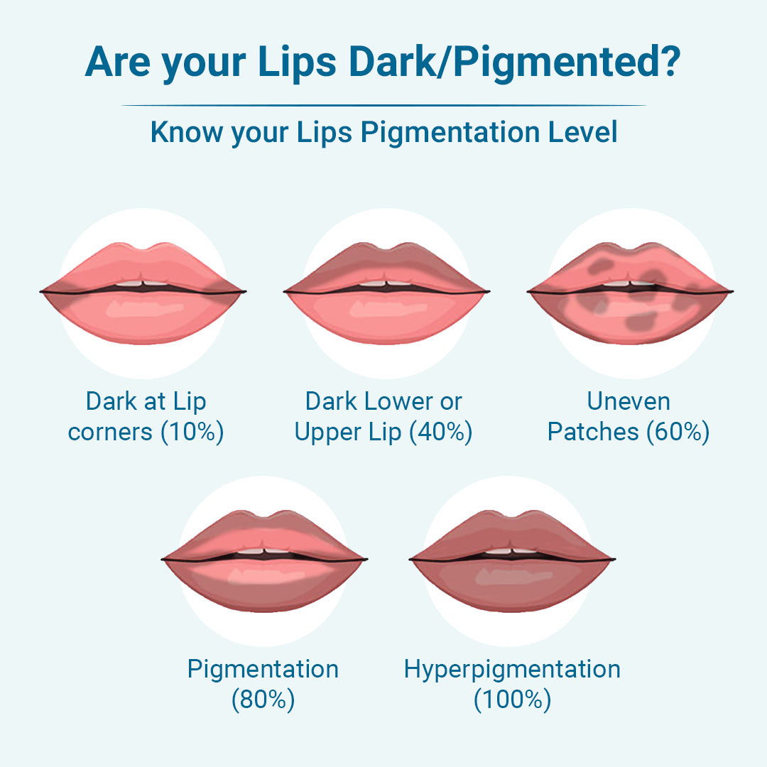 An image showing different levels of lip pigmentation