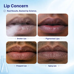 Smoker's Lip Treatment Kit | 4-Step | Men