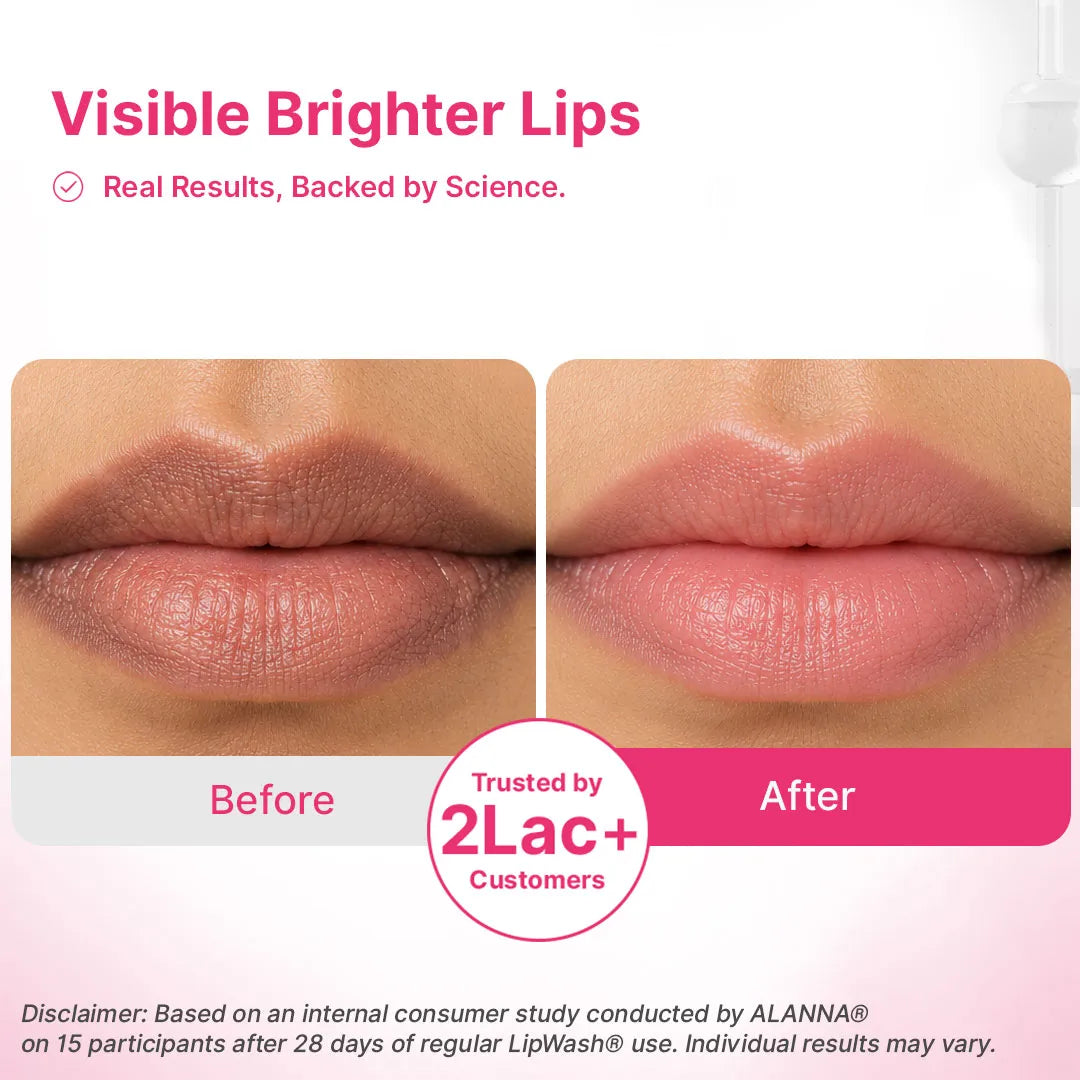 Lip Pigmentation Treatment Kit | 4-Step | Women