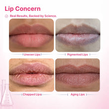 Lip Pigmentation Treatment Kit | 4-Step | Women
