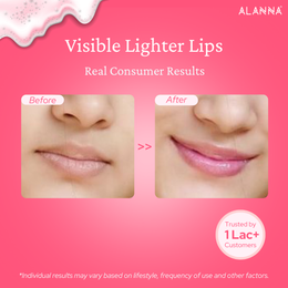 Before and After of Lips